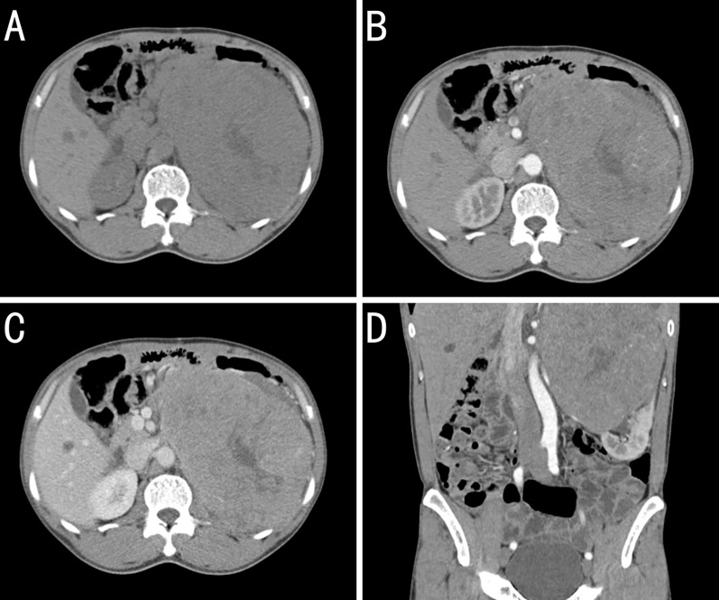 Figure 2