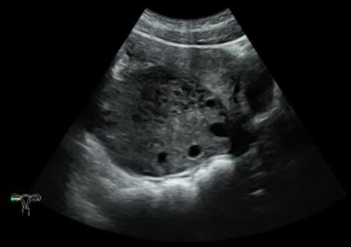 Figure 2