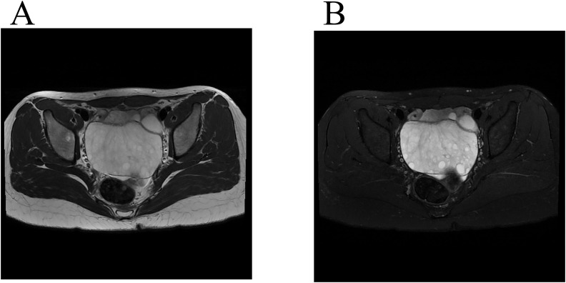 Figure 3