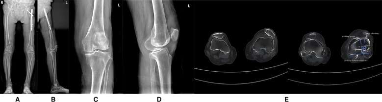 Figure 1