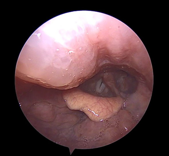 Figure 2