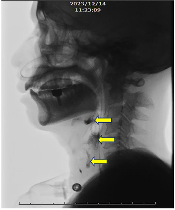 Figure 2