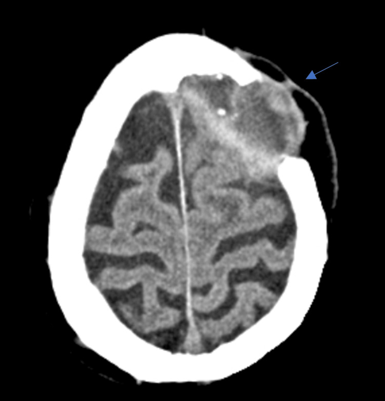 Figure 5