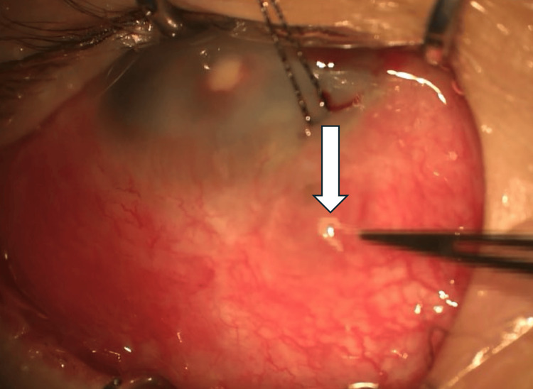 Figure 9