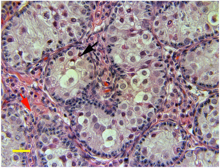 Figure 10