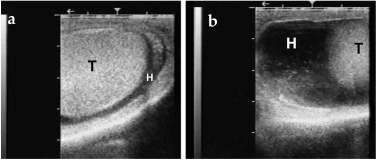Figure 15