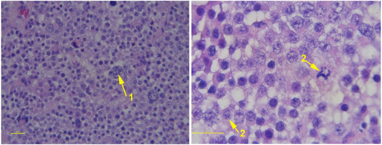 Figure 17