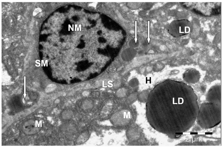Figure 10