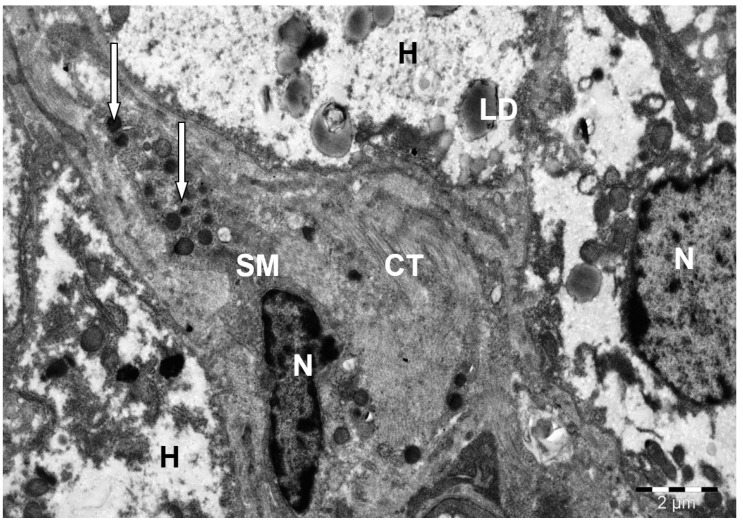 Figure 11