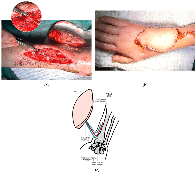 Figure 2