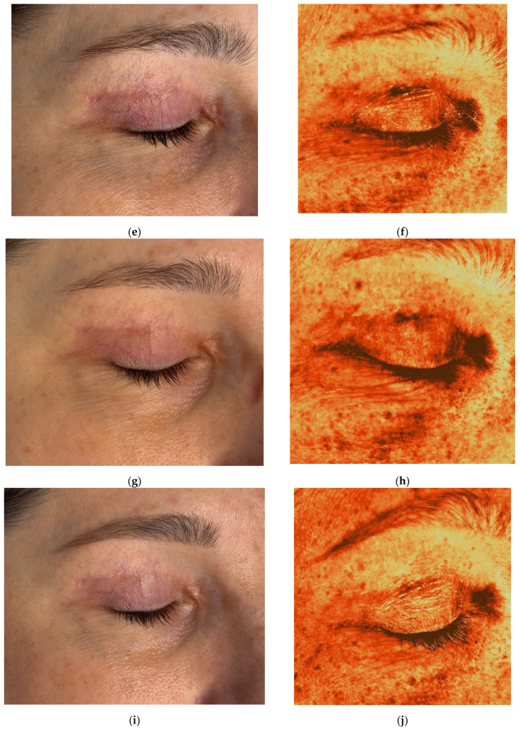 Figure 12