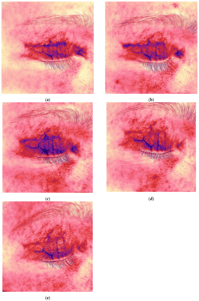 Figure 13
