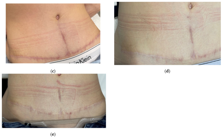 Figure 15