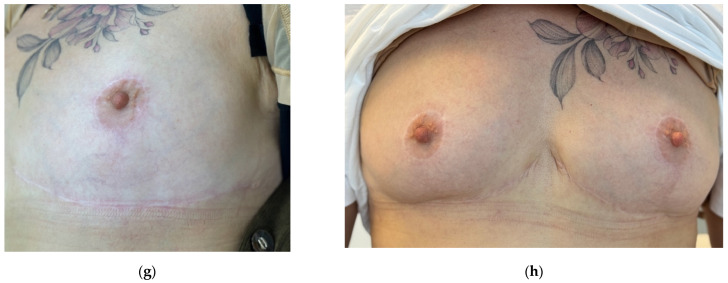 Figure 17