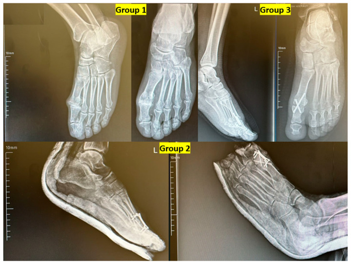 Figure 6