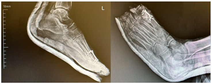 Figure 7