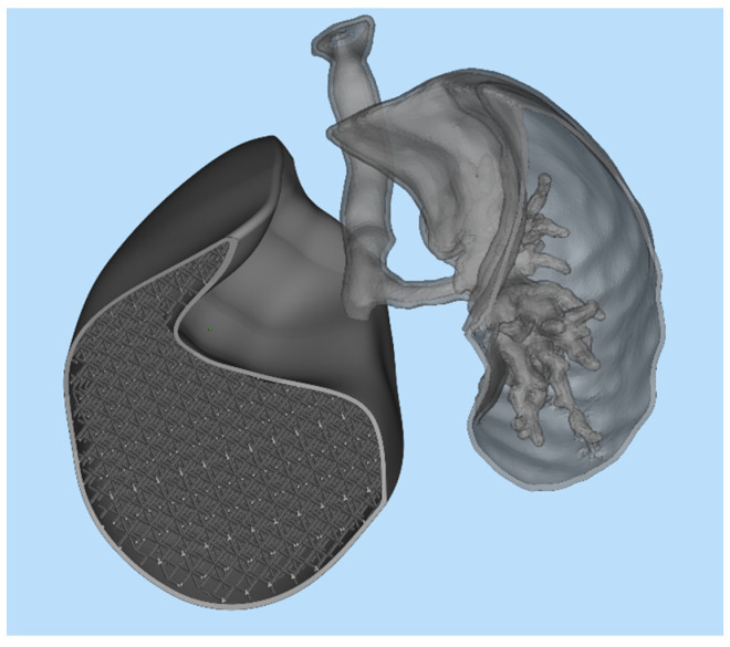 Figure 14