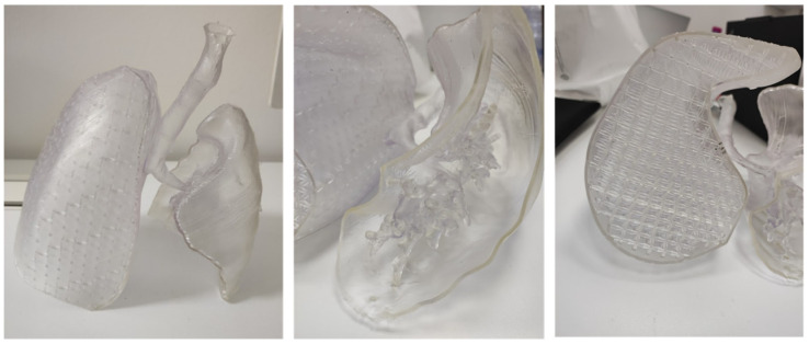 Figure 16