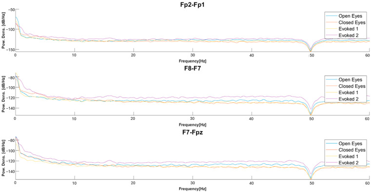 Figure 12