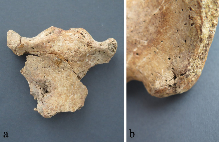 Fig 4