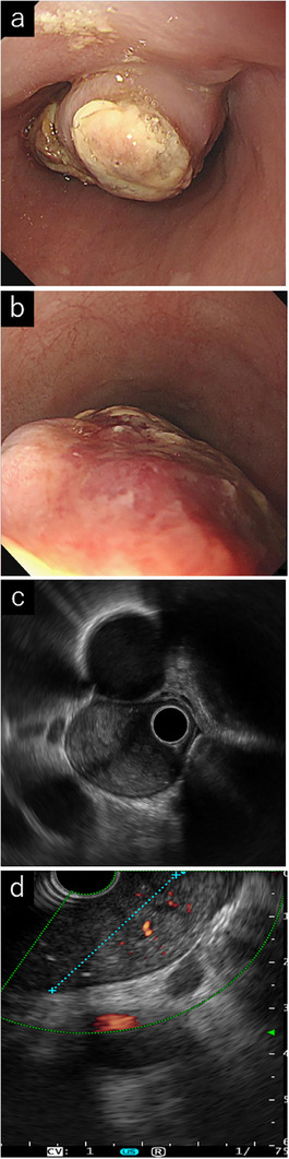 FIGURE 2
