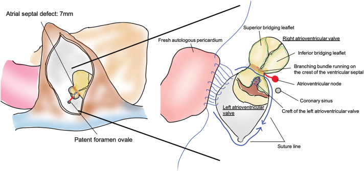 Fig. 3