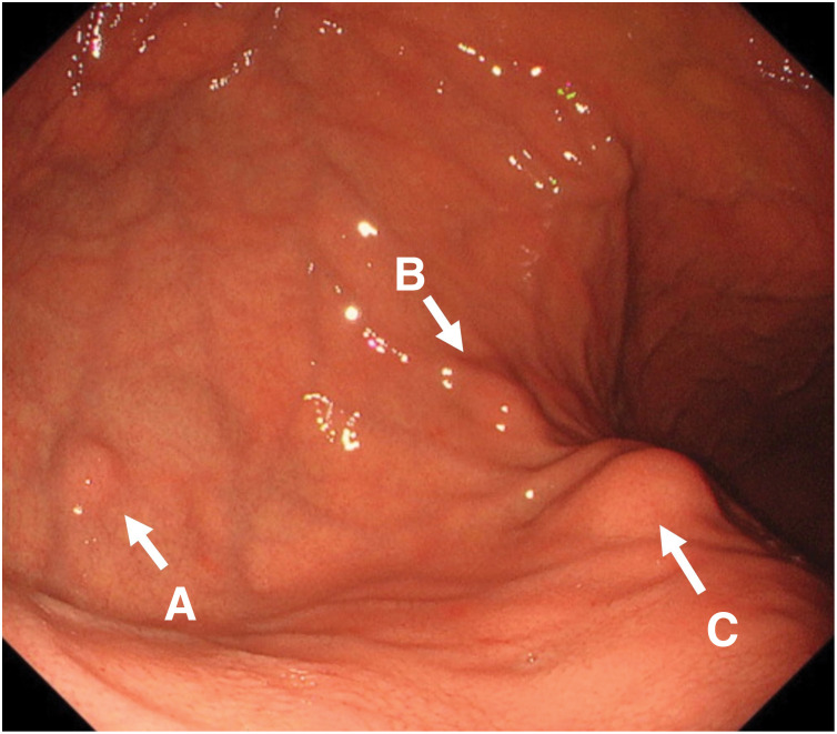 Fig. 3