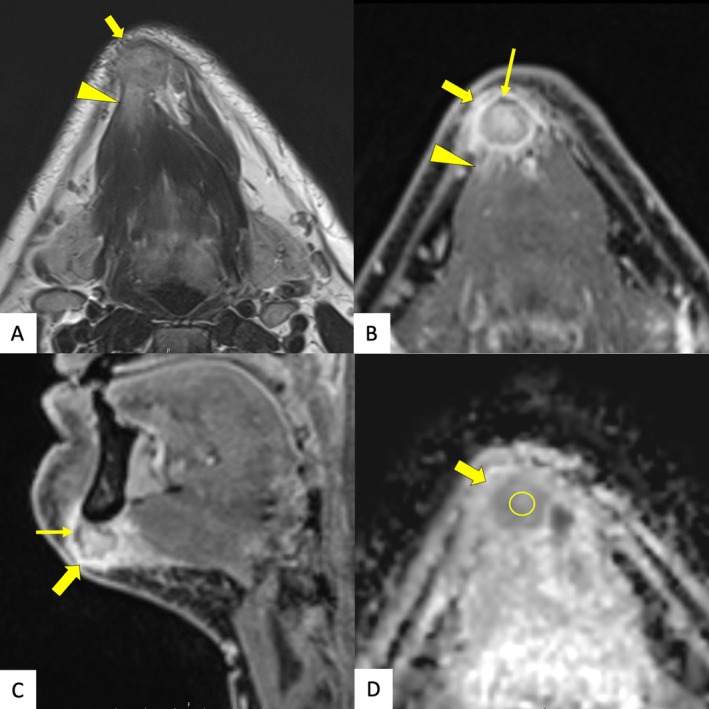 FIGURE 2