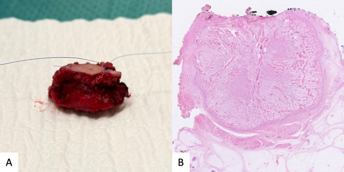 FIGURE 3
