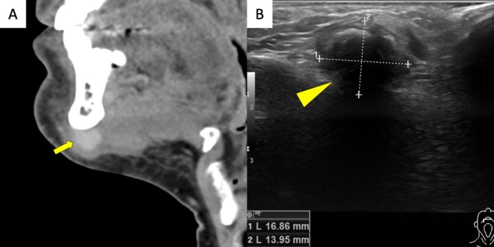 FIGURE 1