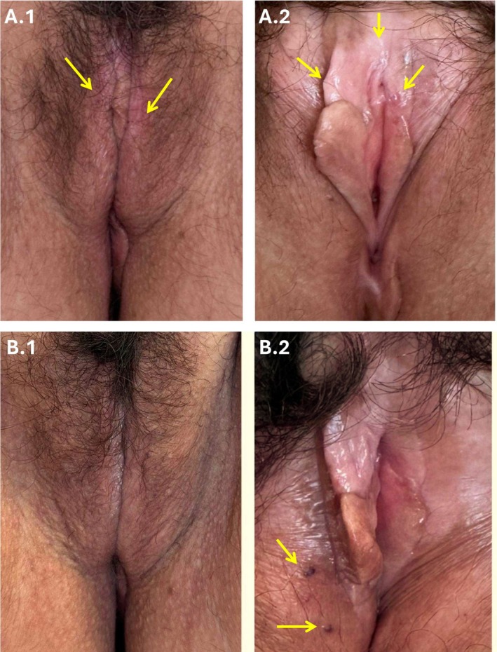 FIGURE 3
