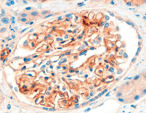 Figure 2