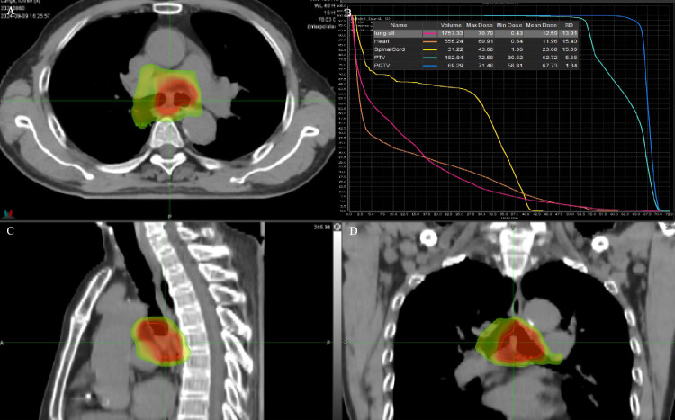 Figure 2