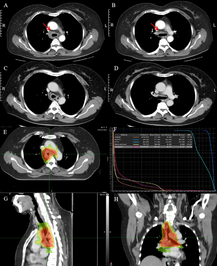 Figure 3