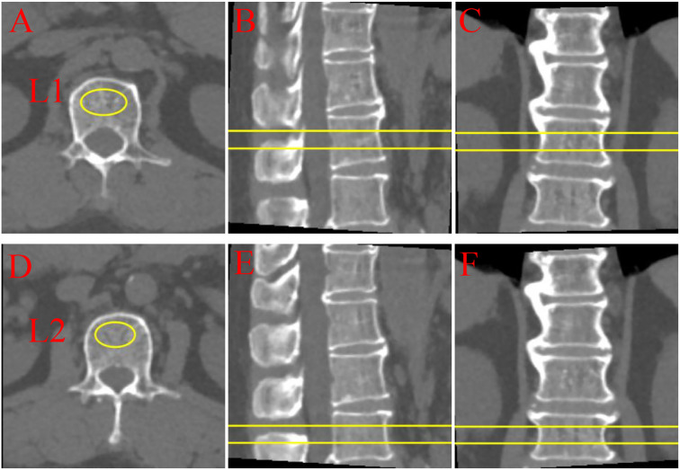 Figure 2