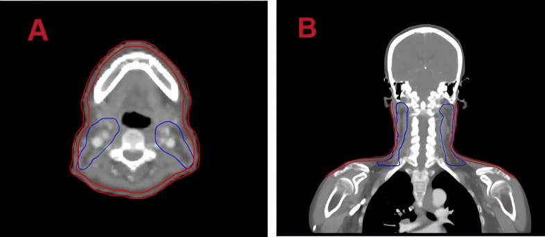 Figure 1