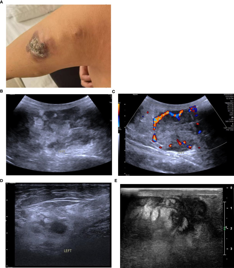 Figure 1