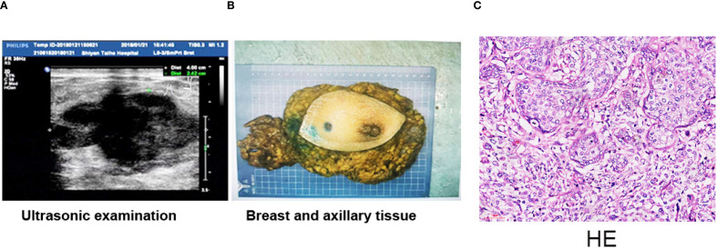 Figure 2