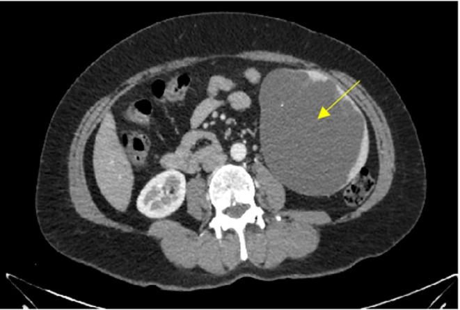 FIGURE 2