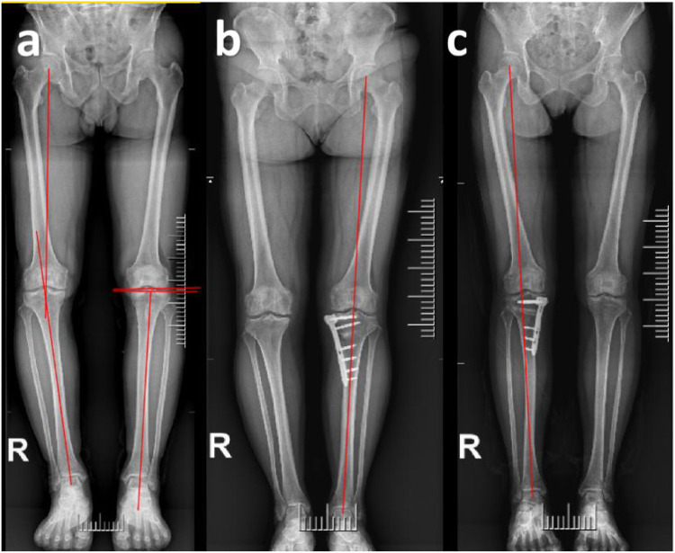 Figure 2