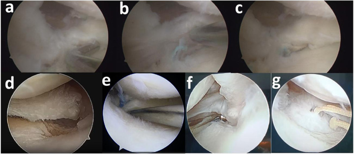 Figure 3