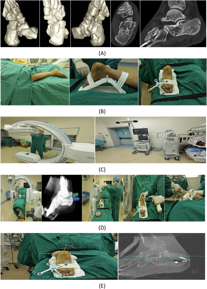 Figure 2