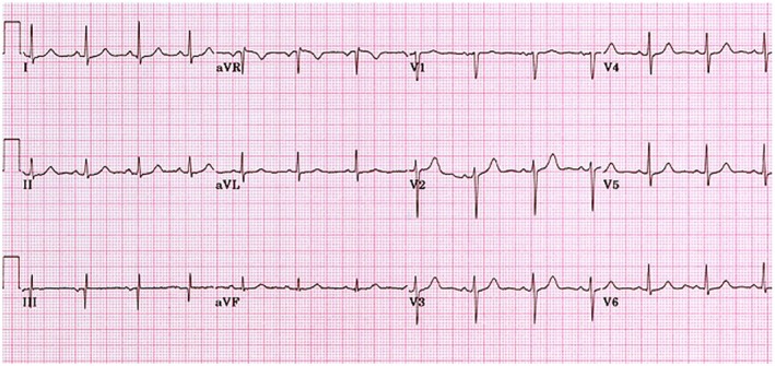 FIGURE 1