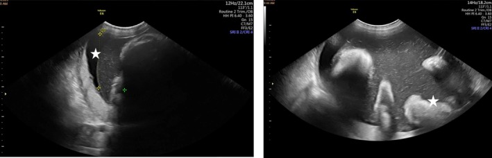 FIGURE 3