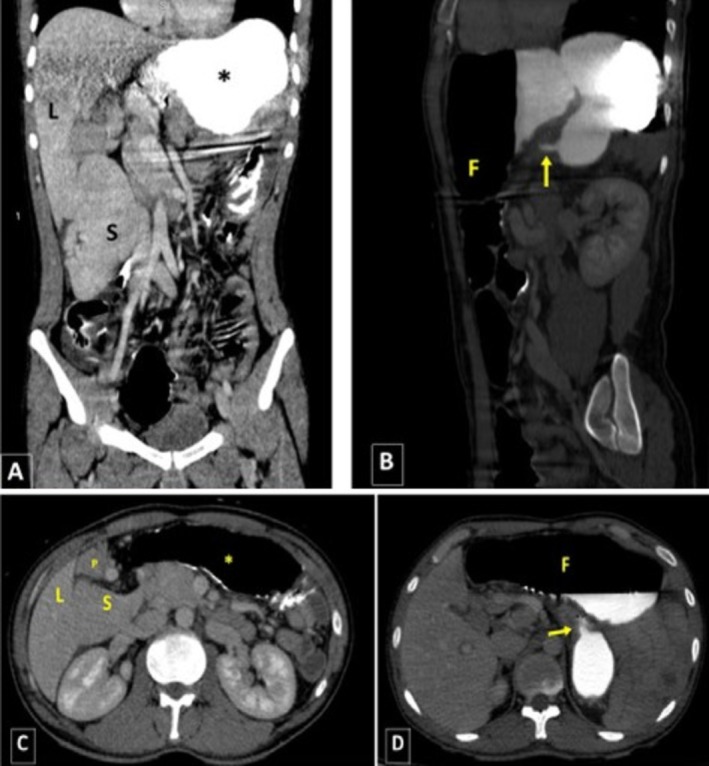 FIGURE 6