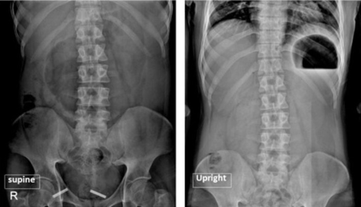 FIGURE 1