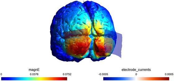 FIGURE 2