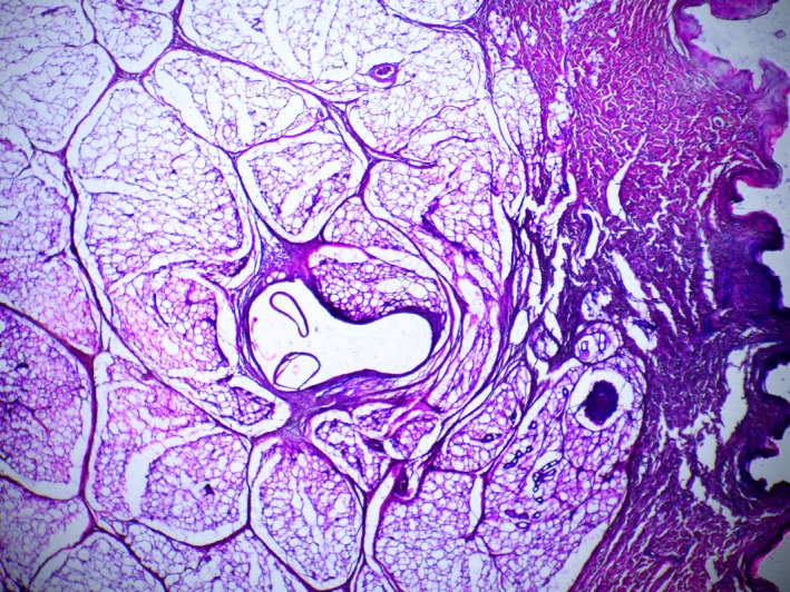 FIGURE 11