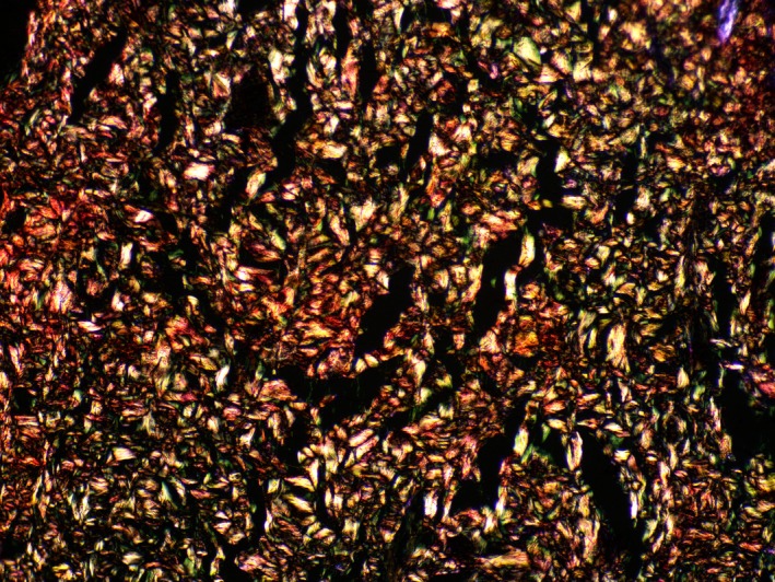 FIGURE 6