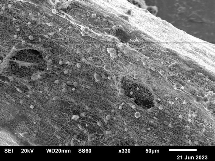 FIGURE 3